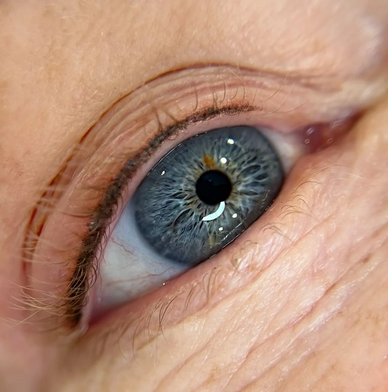 Long-Term Eye Health Concerns
